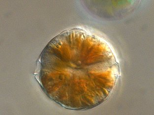 Ein gesunder Dinoflagellat aus der Gattung Alexandrium.