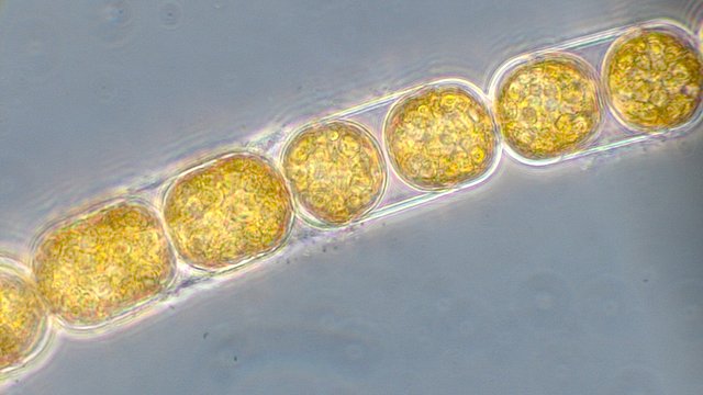 Im Lichtmikroskop werden die langen Ketten der einzelligen Algen sichtbar. Die Algen erscheinen orangebraun, wegen des Farbstoffs Fucoxanthin, durch den auch bei wenig Licht noch Photosynthese möglich ist.
