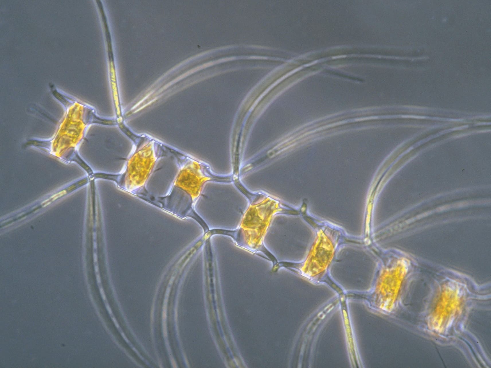 Antarctic diatom from the genus Chaetoceros.